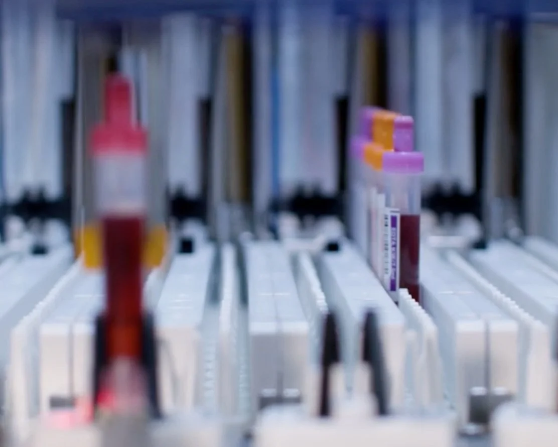 Pneumatic Tube Systems in Hospitals - Close up