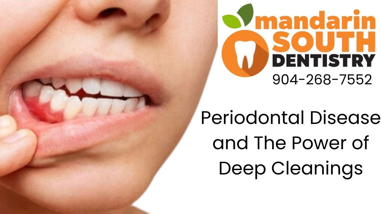 Understanding Periodontal Disease and the Power of Deep Cleanings
