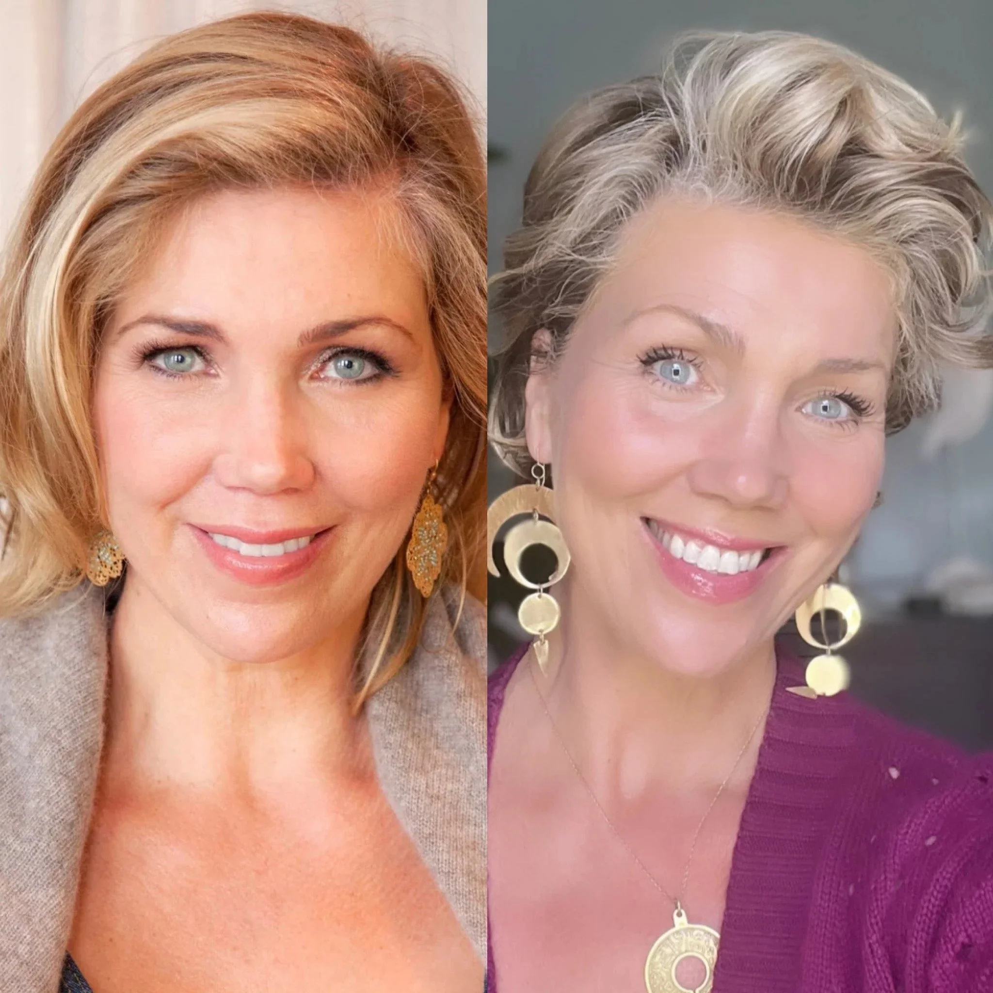 quit botox with amy wall 10 year before and after