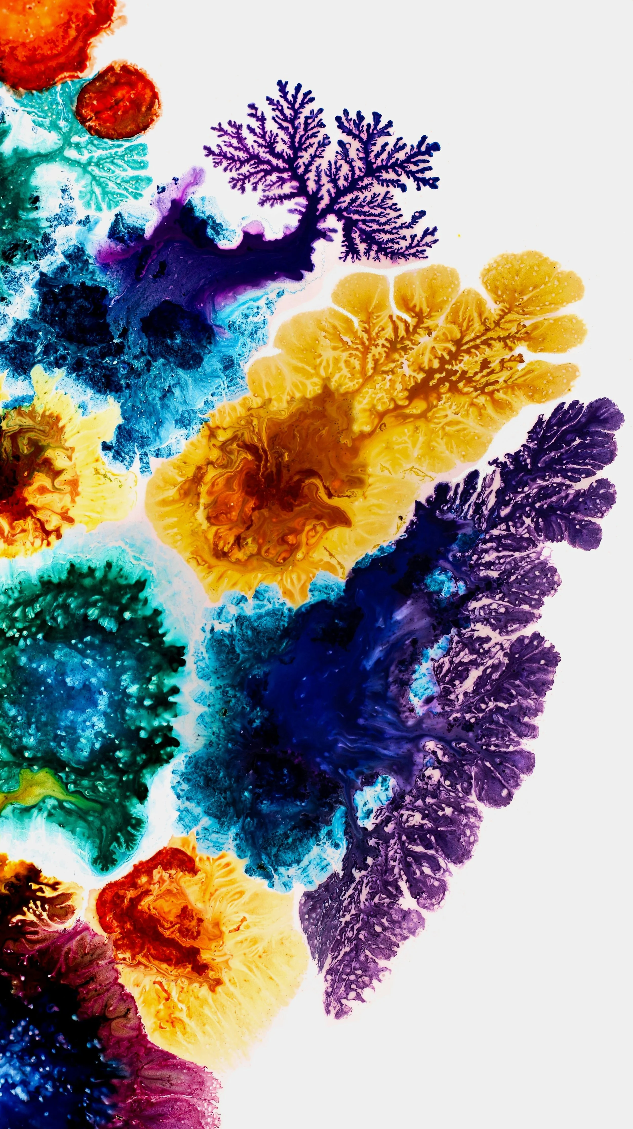 Is Functional Neurological Disorder Psychological or Neurological?