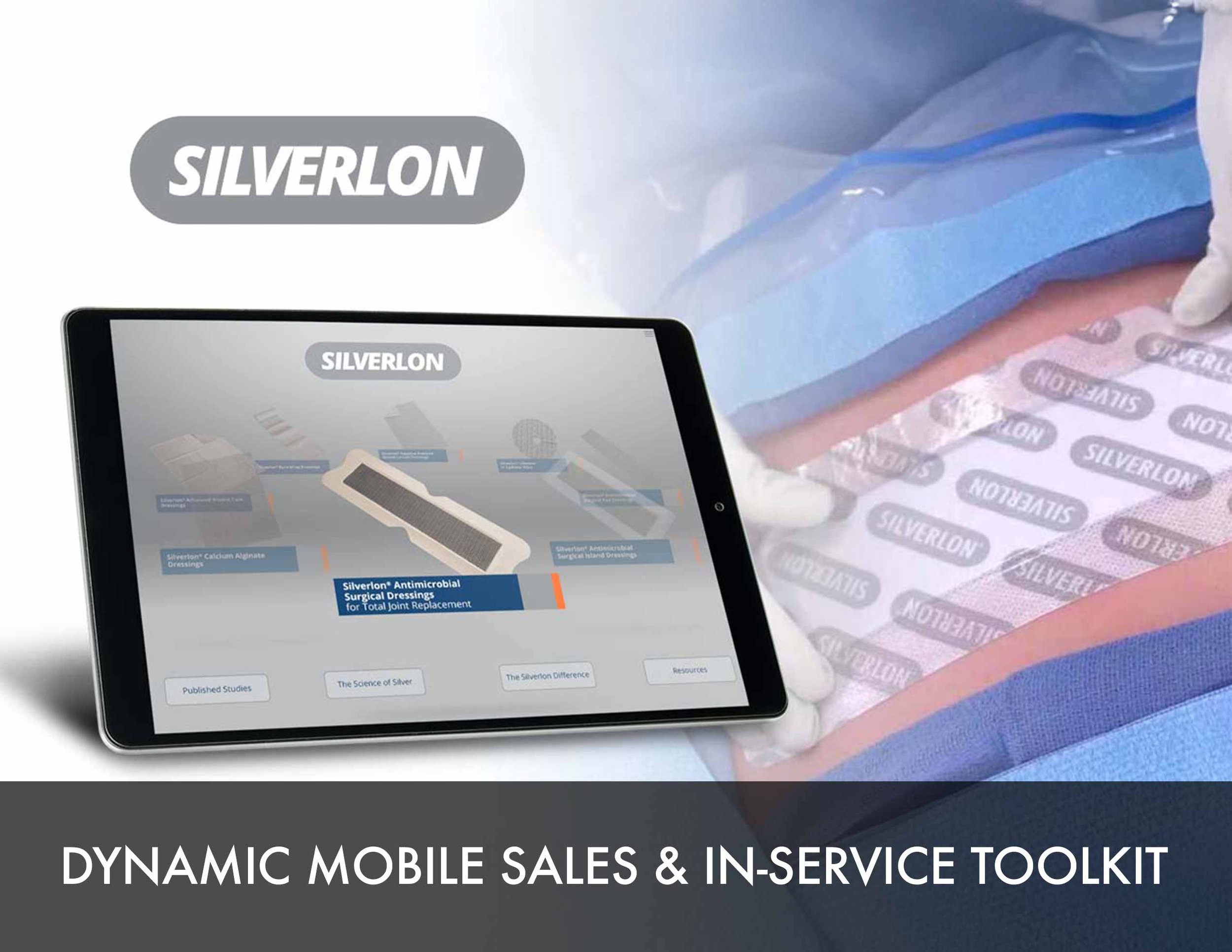 Silverlon-case-study-main-image.jpg