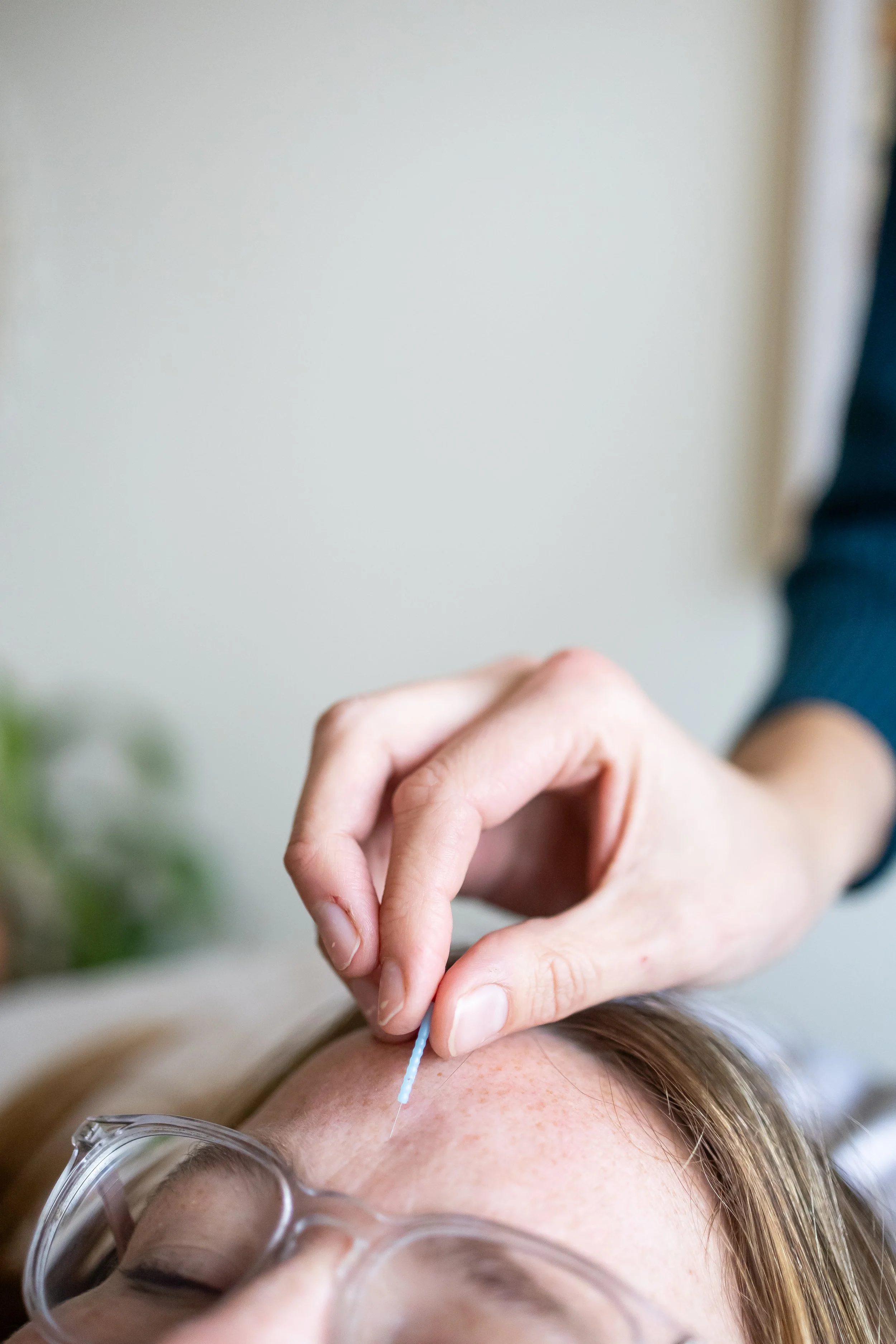 Mei Zen Cosmetic Acupuncture