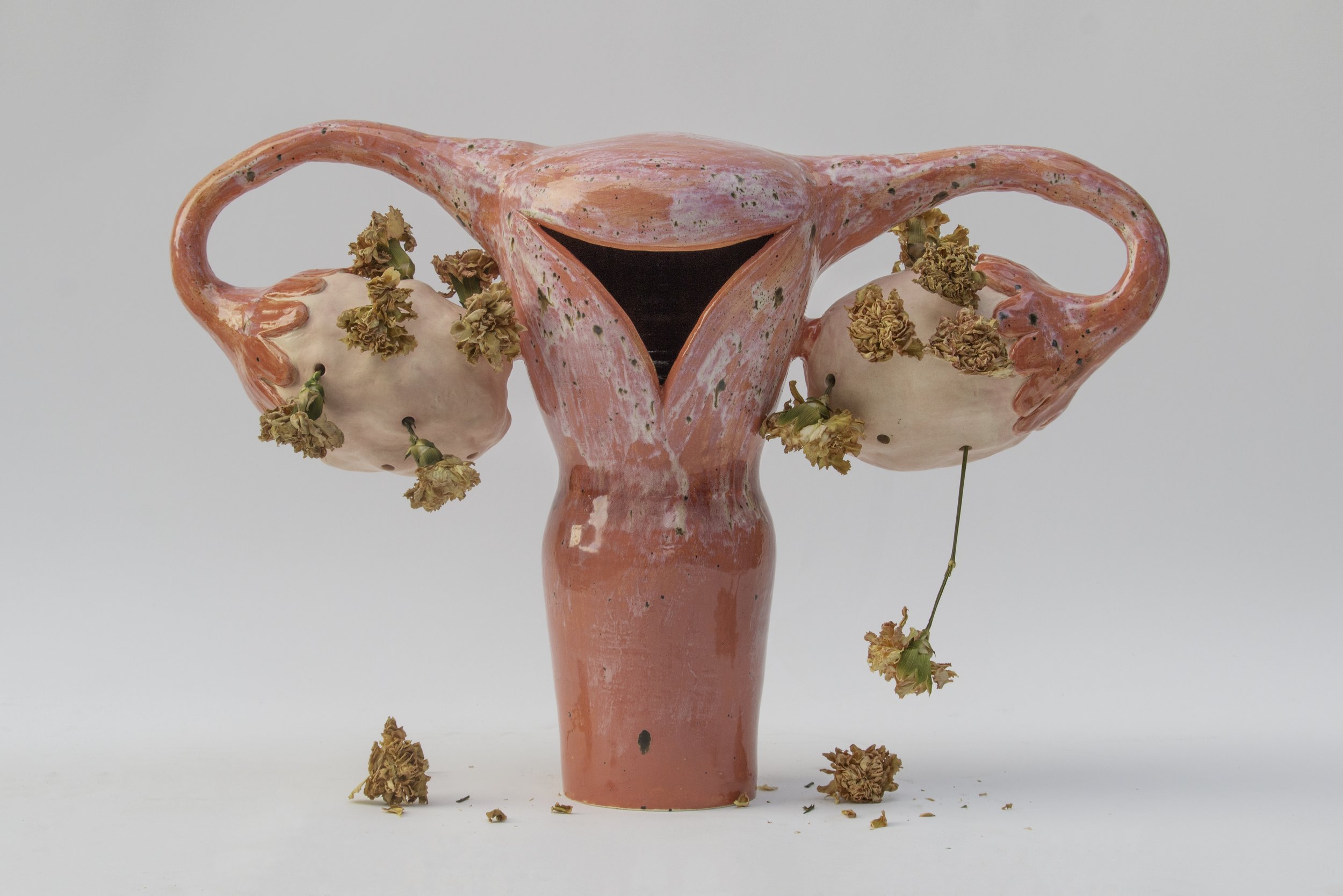 Uterus_dried.jpg