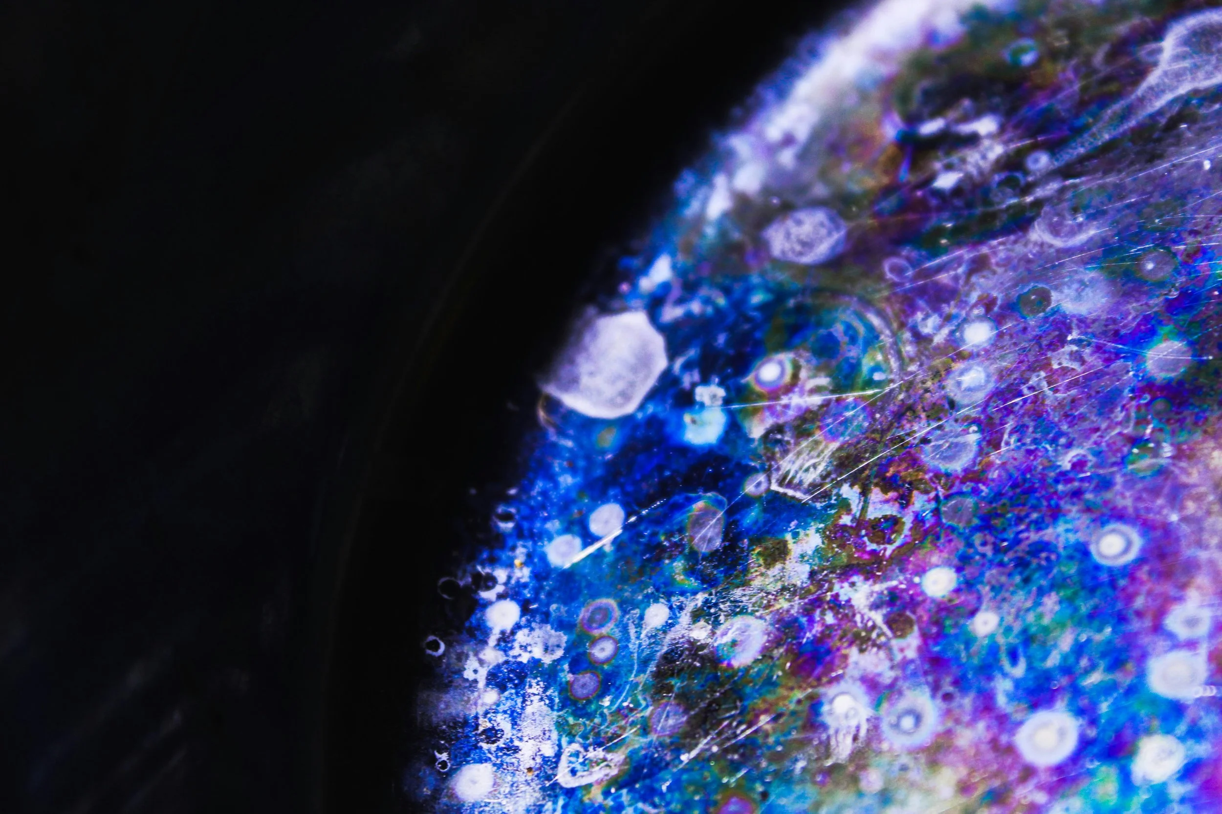 What Ketamine Actually Feels Like— From Someone Who Has Been in the Chair