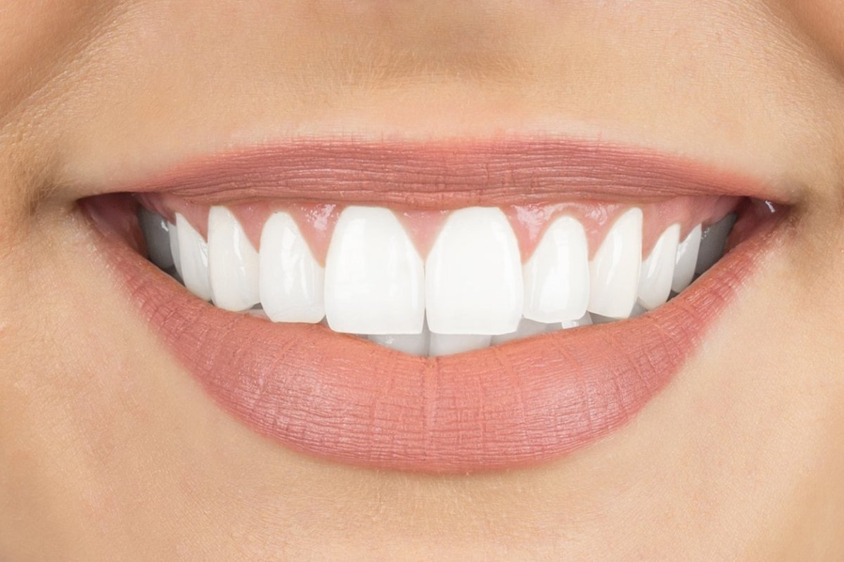 32. Bright Smile