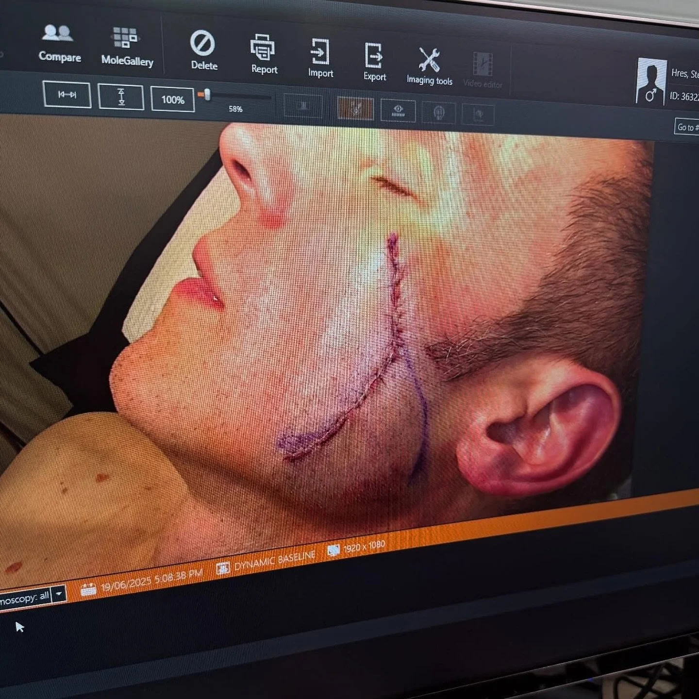 A few months ago our CEO Jay Allen received a call 📞 from Stephen Hres asking if we can help him get a mole checked. Jay got him an appointment urgently. 
&ldquo;On Tuesday 1 April 2025,  I had an appointment booked with my family GP, Dr Sanj (Sanje