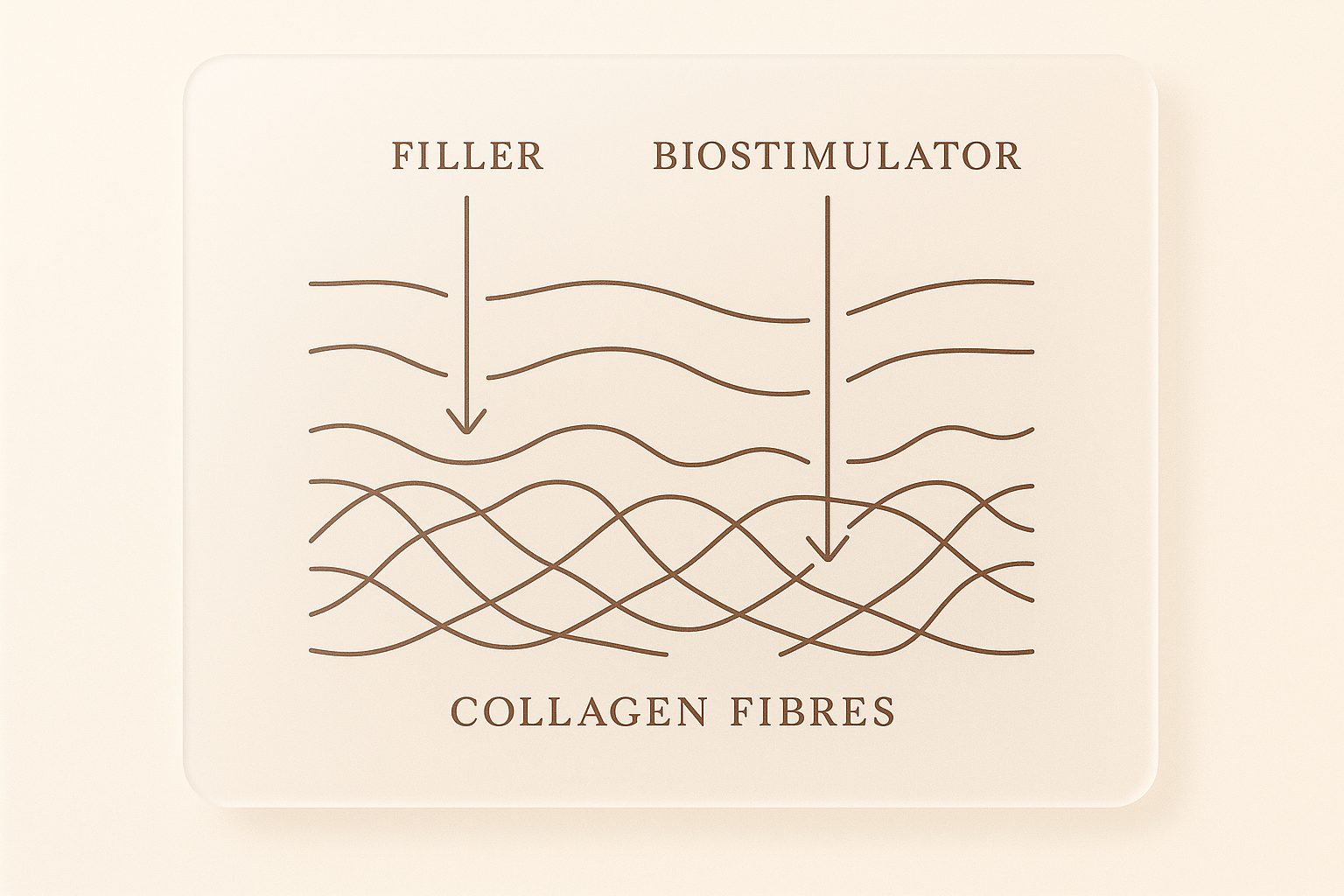 Biostimulators vs. Fillers: Why Collagen-Stimulating Treatments Are the New Go-To for Natural Results