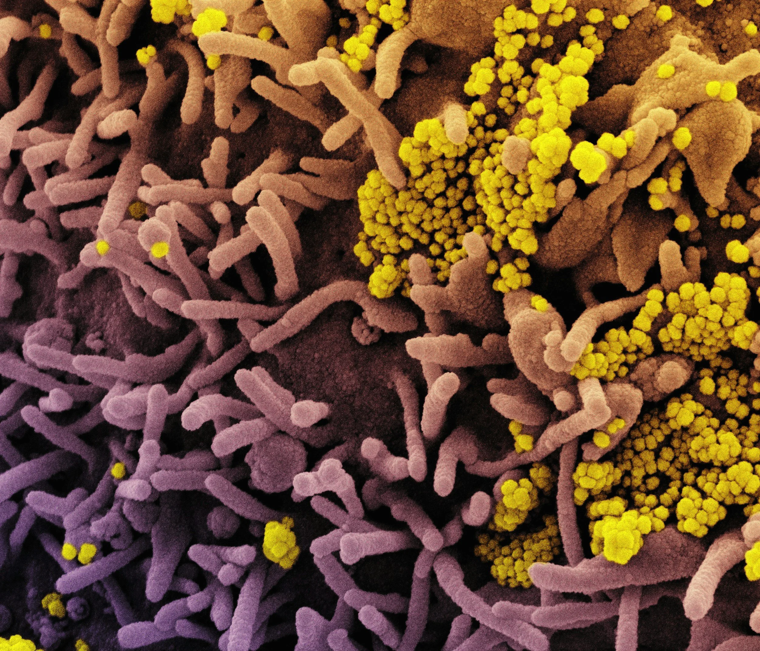 The Pregnancy Microbiome: How to Support It for a Healthier Baby