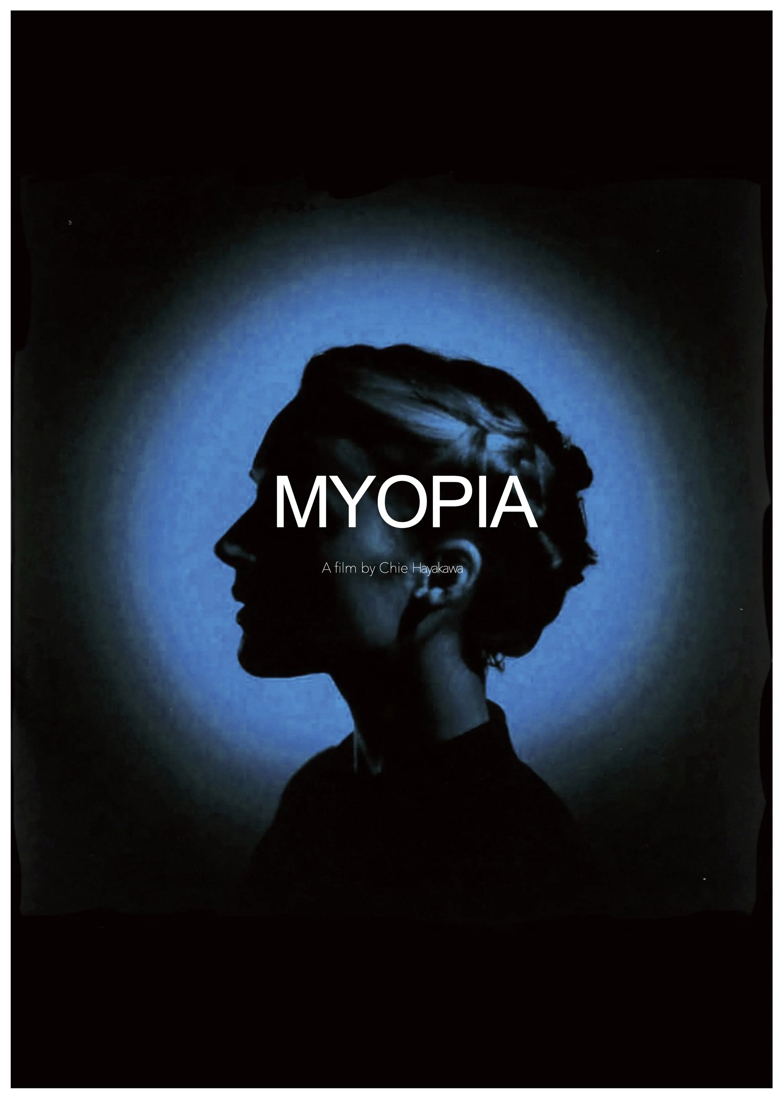 MYOPIA