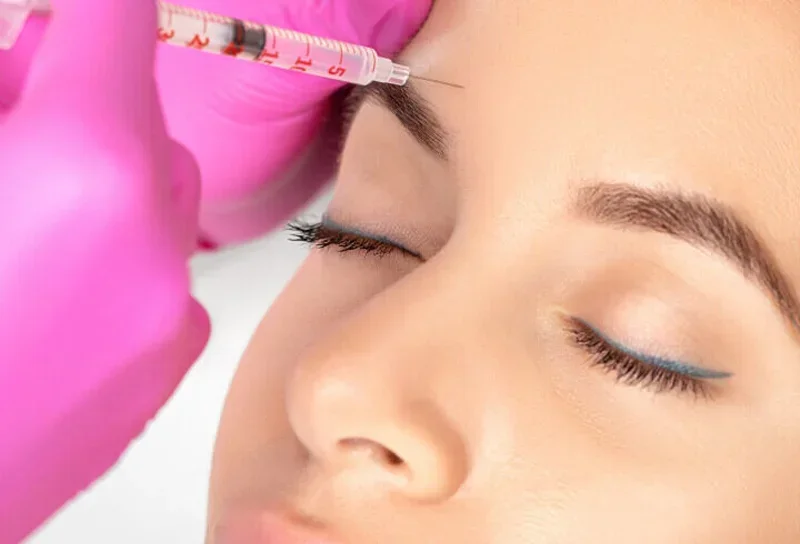 A Guide to Correcting Forehead Lines With Dermal Fillers