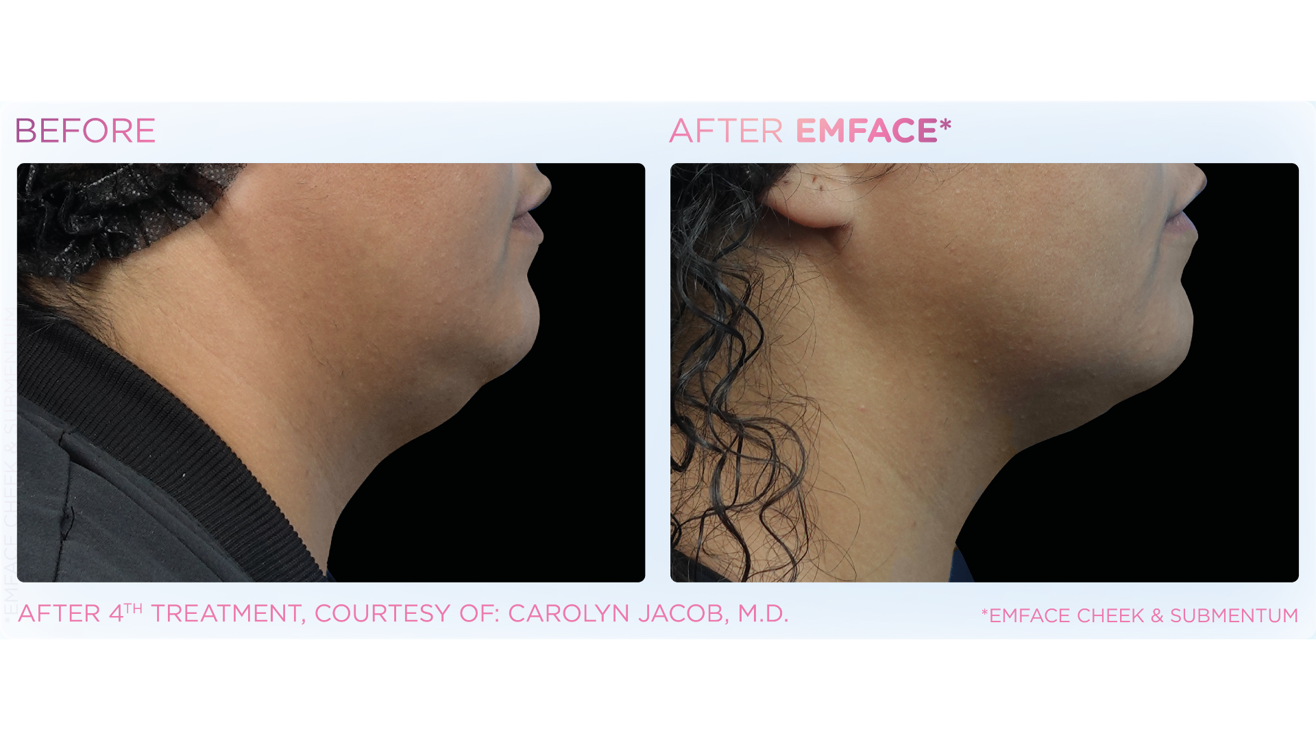 Ideal U Face & Body Wellness (5).png