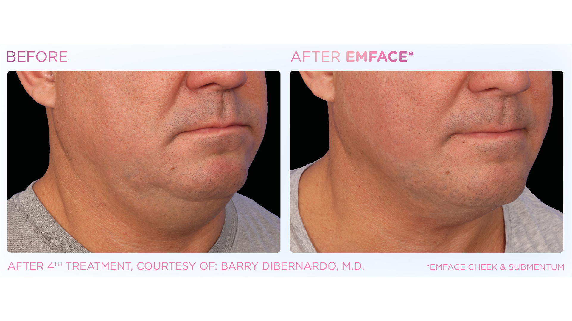 Ideal U Face & Body Wellness (6).png