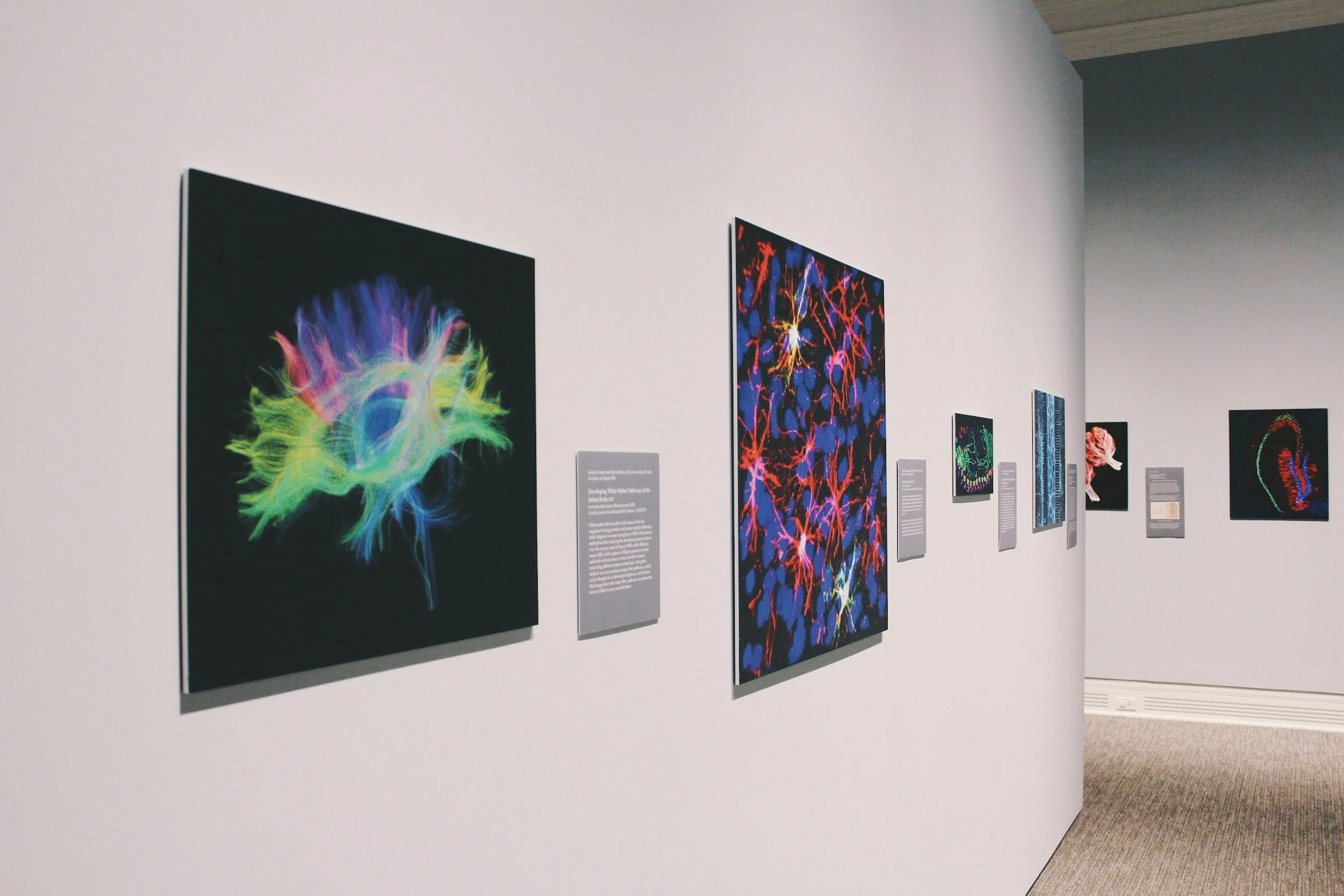Gallery wall with framed colorful abstract artwork featuring neon-like designs on a white wall.