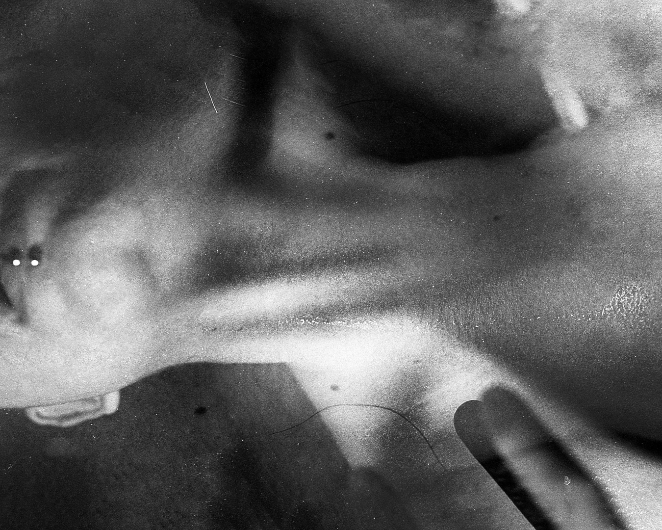 The grief no one talks about after an STI diagnosis