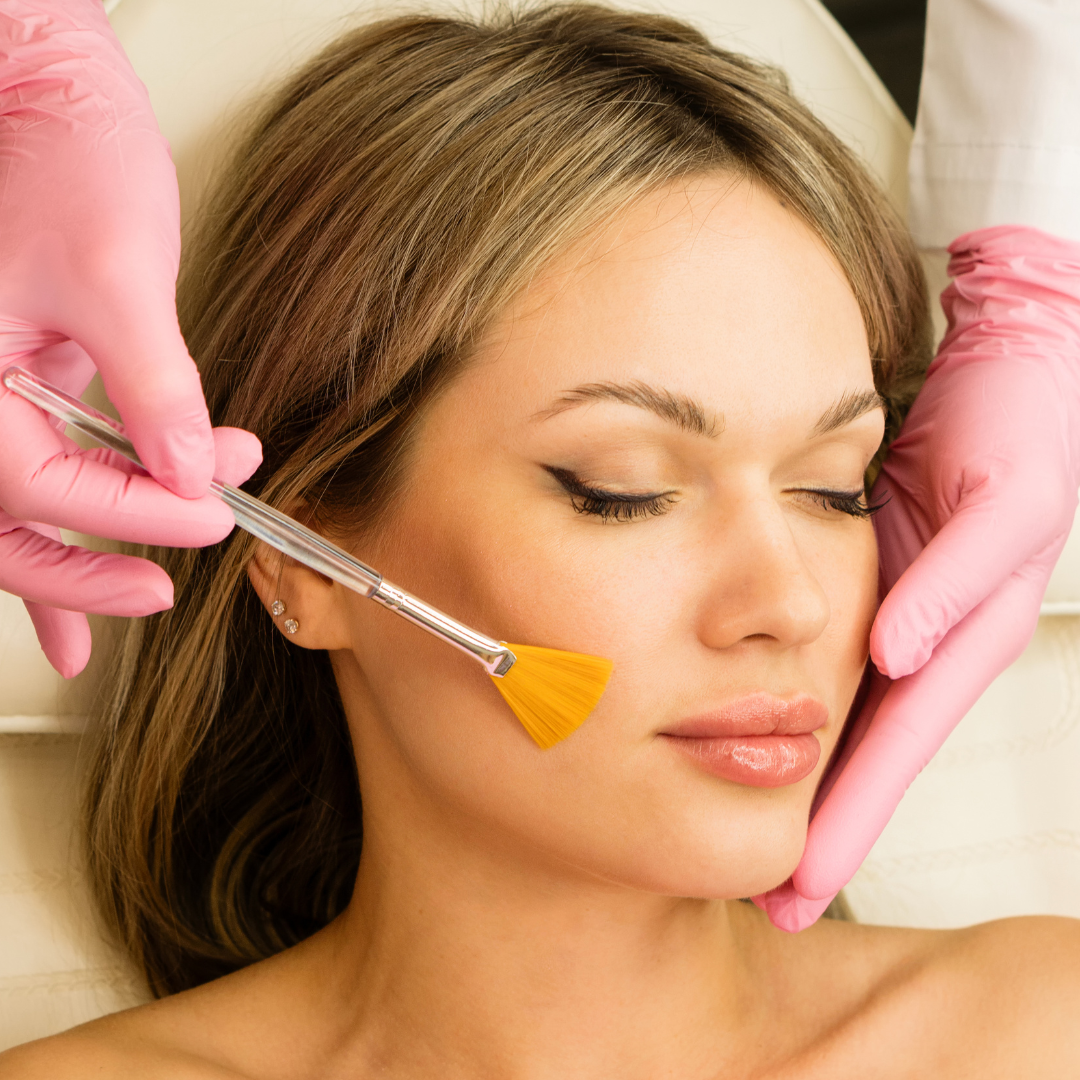 Medspa in Barrington, IL, 60010 l Chemical Peels Near Me