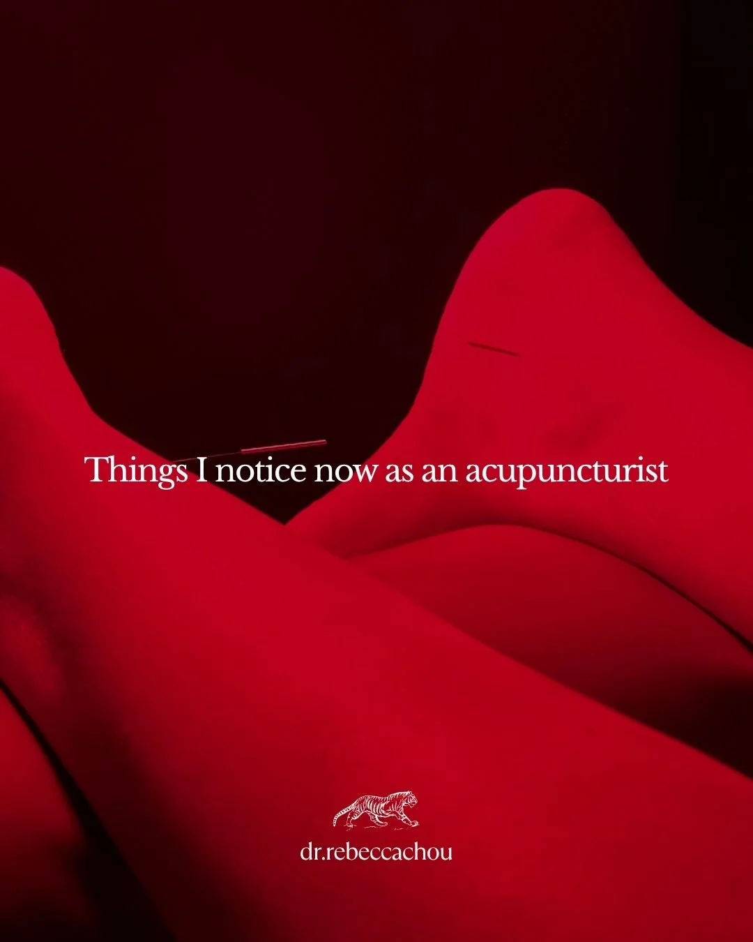 I swear becoming an acupuncturist has changed the way I look at people 😂
I notice little things now that I probably would've overlooked before &mdash; how someone talks about their sleep, how they describe their pain, how stress shows up in the body
