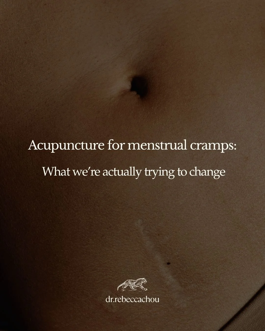 Menstrual cramps are common&mdash;but that doesn&rsquo;t mean you have to simply accept them as something you have to live with.
In Chinese medicine, we&rsquo;re not just looking at where the pain is. We&rsquo;re looking at the pattern behind it.
Whe