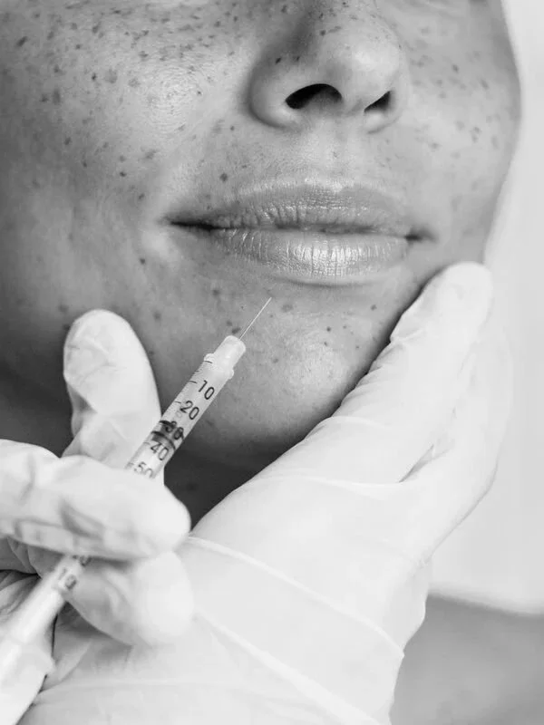 lip and dermal filler