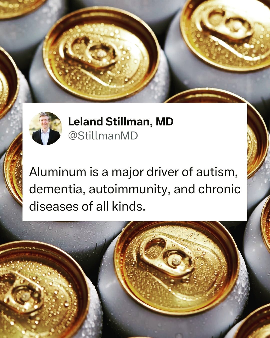 True story - A heavy metal detox changed my life and brought my cognition back online.

Aluminium is one of those things that feels almost invisible until you start noticing how often it shows up in the things we use every day. 

Imagine opening a co