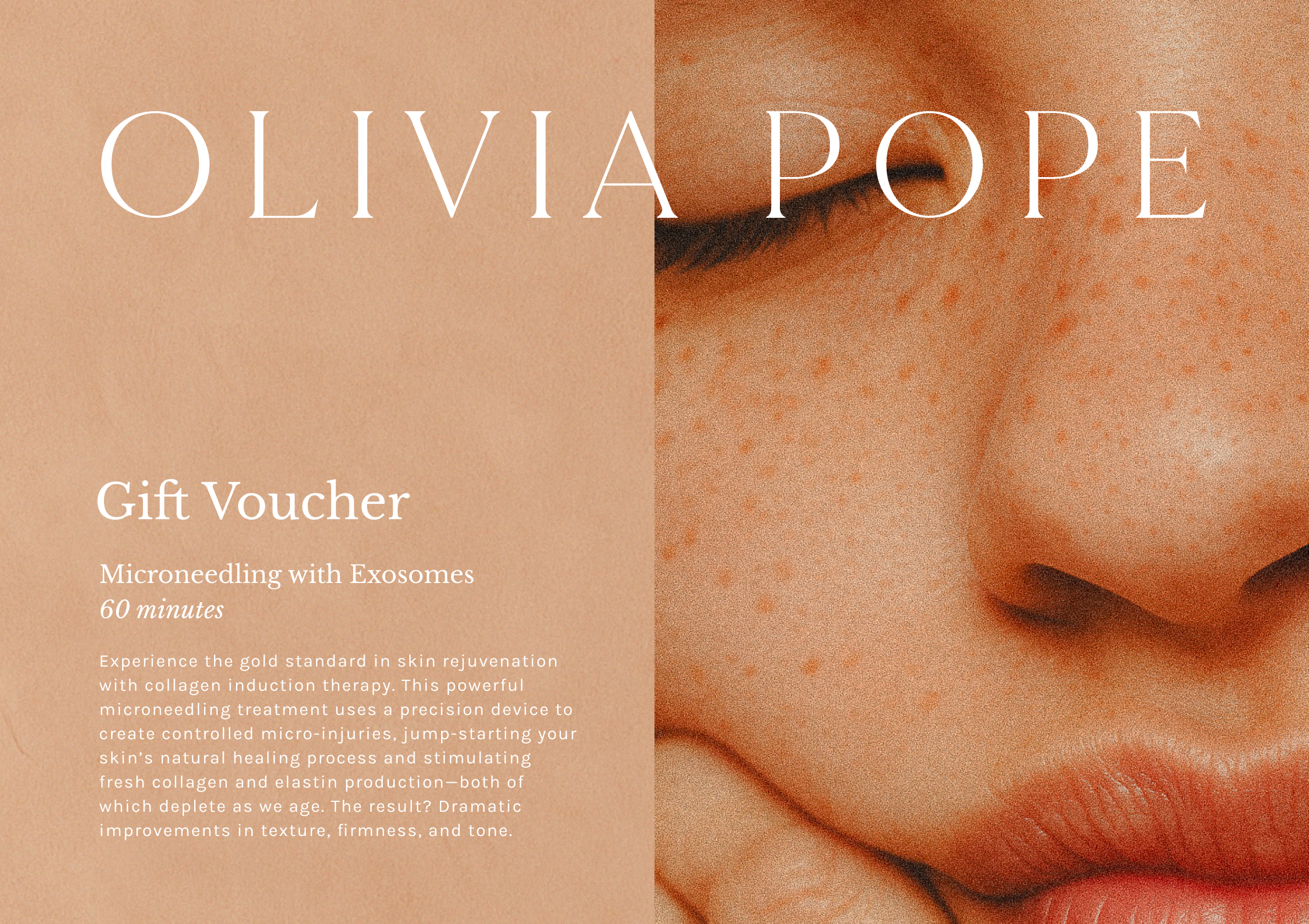 Microneedling with Exosomes gift card.png