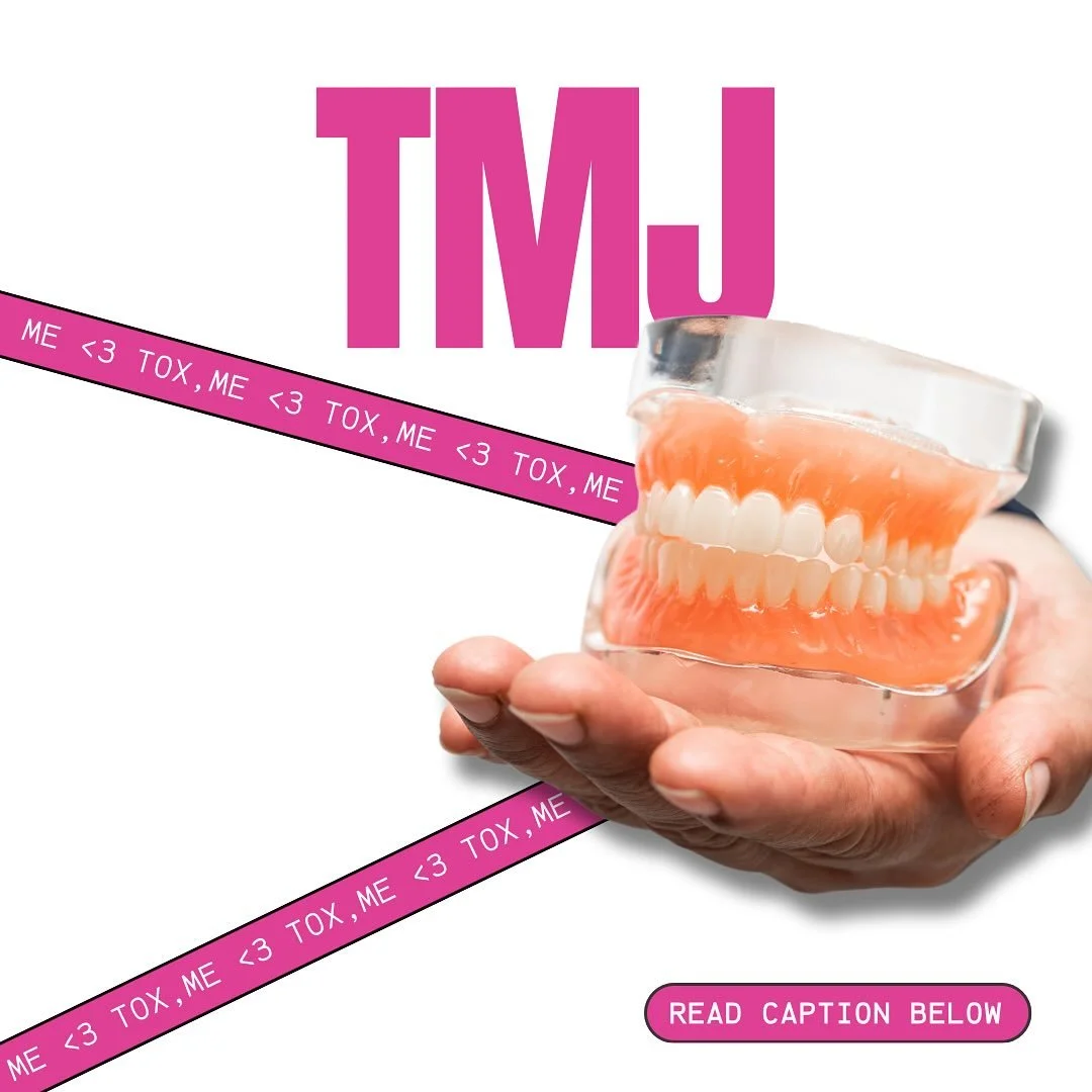 Tox such as xeomin can be used to relax overworked jaw muscles that may feel tight from habits like clenching or grinding. By softening these muscles, many people notice less tension and a slimmer, more contoured look to the lower face. 

✨ Have more