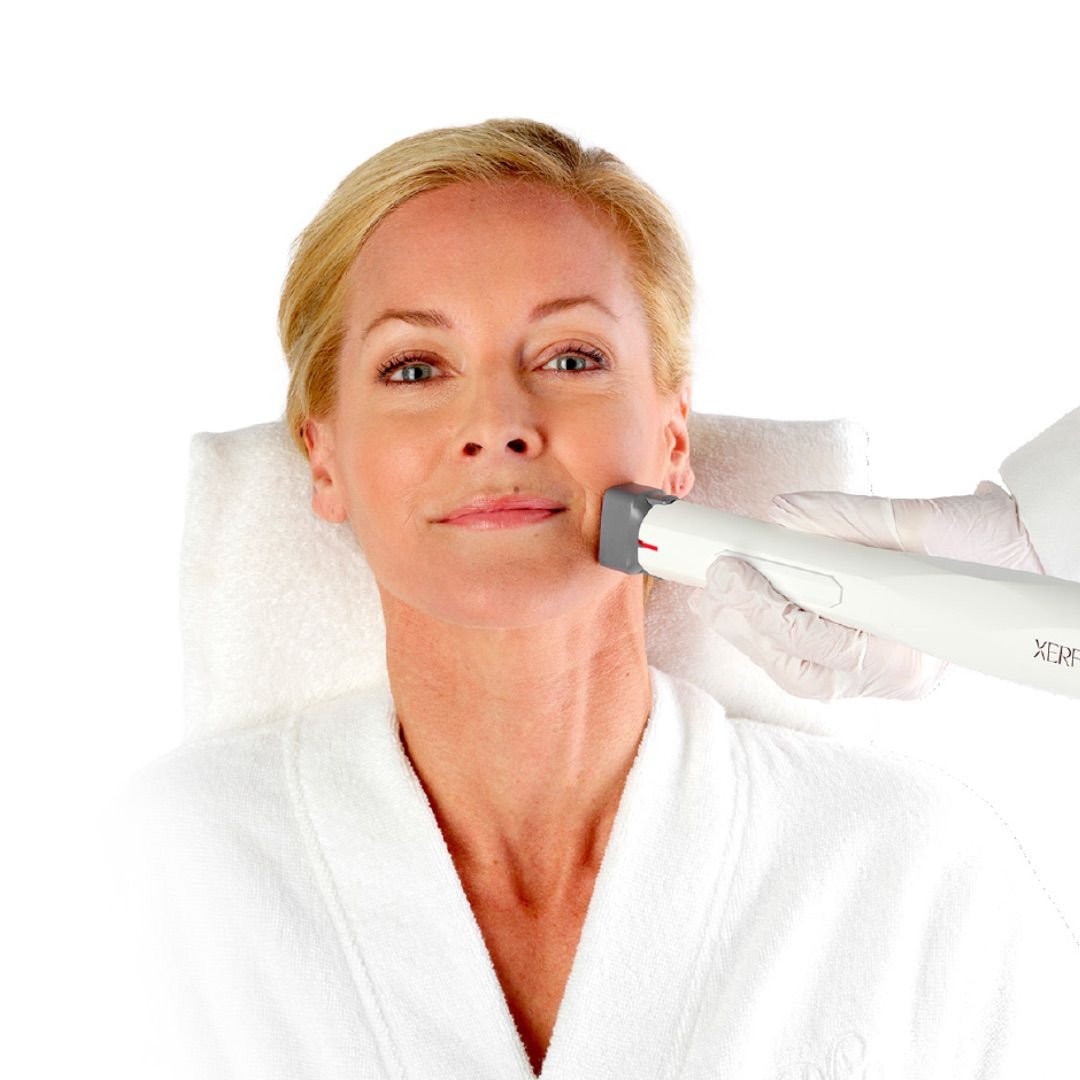 Lutronic-XERF-RF-Skin-Tightening-1.jpg