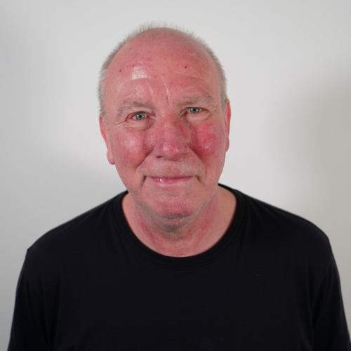 Close-up of an elderly man with a red face, short light hair, and wearing a black shirt, smiling against a plain white background.