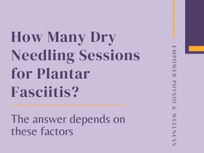 In this blog post, you will learn how many dry needling sessions are needed for plantar fasciitis, as explained by a physical therapist.