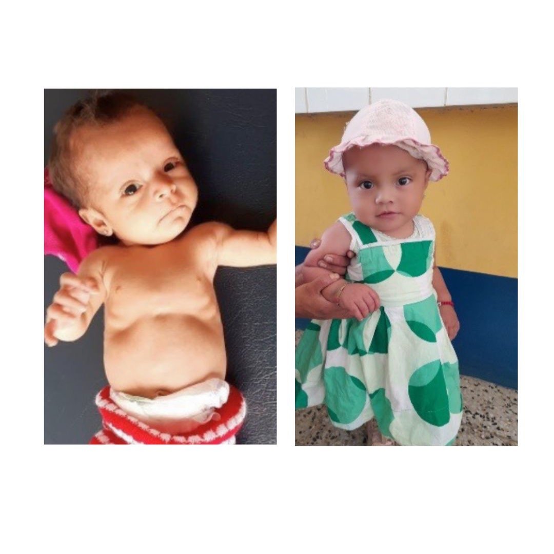 When Andely joined our nutrition programme, she was severely malnourished. The family didn&rsquo;t have access to clean drinking water. Staying well hydrated was essential for her mother to produce breast milk.
Our team supported the family with wate