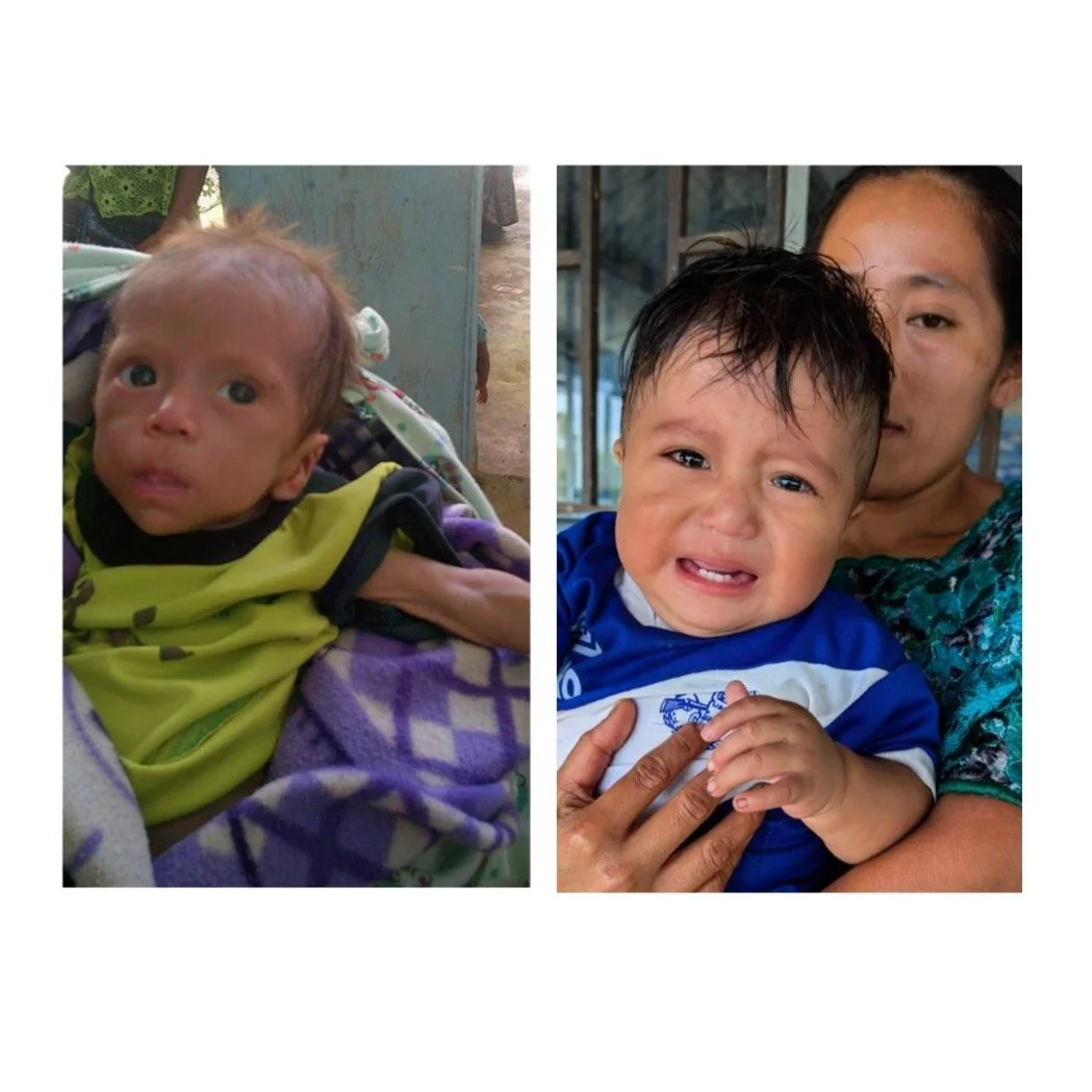 Jose&rsquo;s mother was unable to nurse him and also suffered from mental health issues after giving birth, so the child's father and an older sister had to take care of him. 

Living in extreme poverty, they were unable to pay for formula and Jose&r