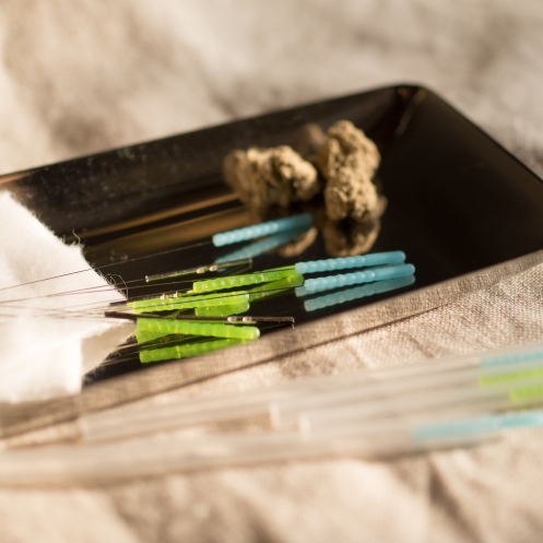 “Flip the Script: Acupuncture for Breech Babies Explained” 