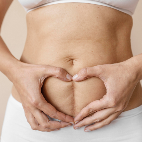 C-Section Scar Care: Evidence-Based Ways to Support Healing Naturally