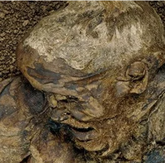 Lindow Man: A Bog Body Mystery