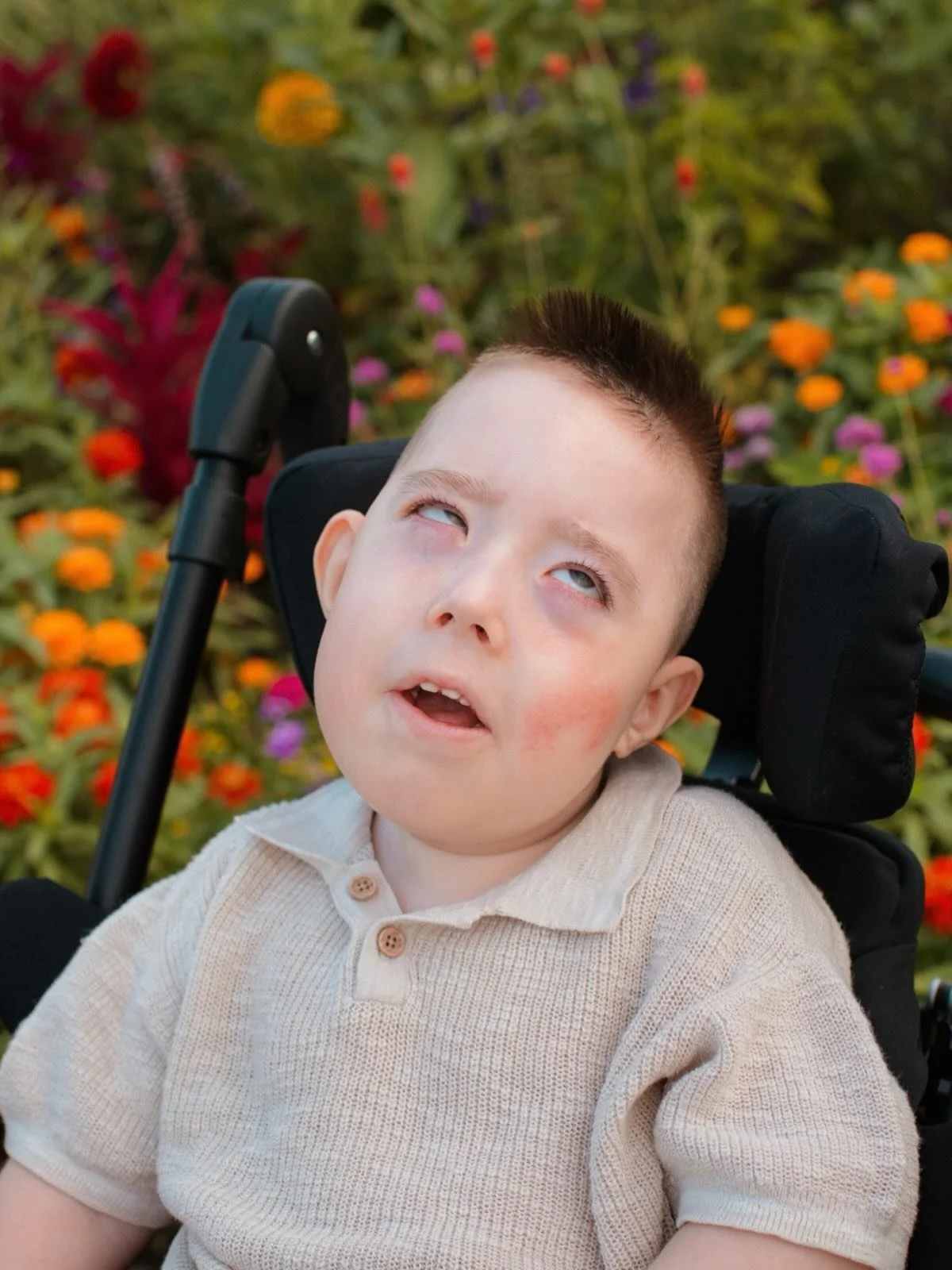 Our reason why and the heart of the Dax Blattner Foundation: Our sweet, miraculous little boy, Dax. &hearts;️
&mdash;
The dragonfly in our logo is our way of honoring Dax. Dax was born with a rare genetic disorder: Pontocerebellar Hypoplasia Type 8. 