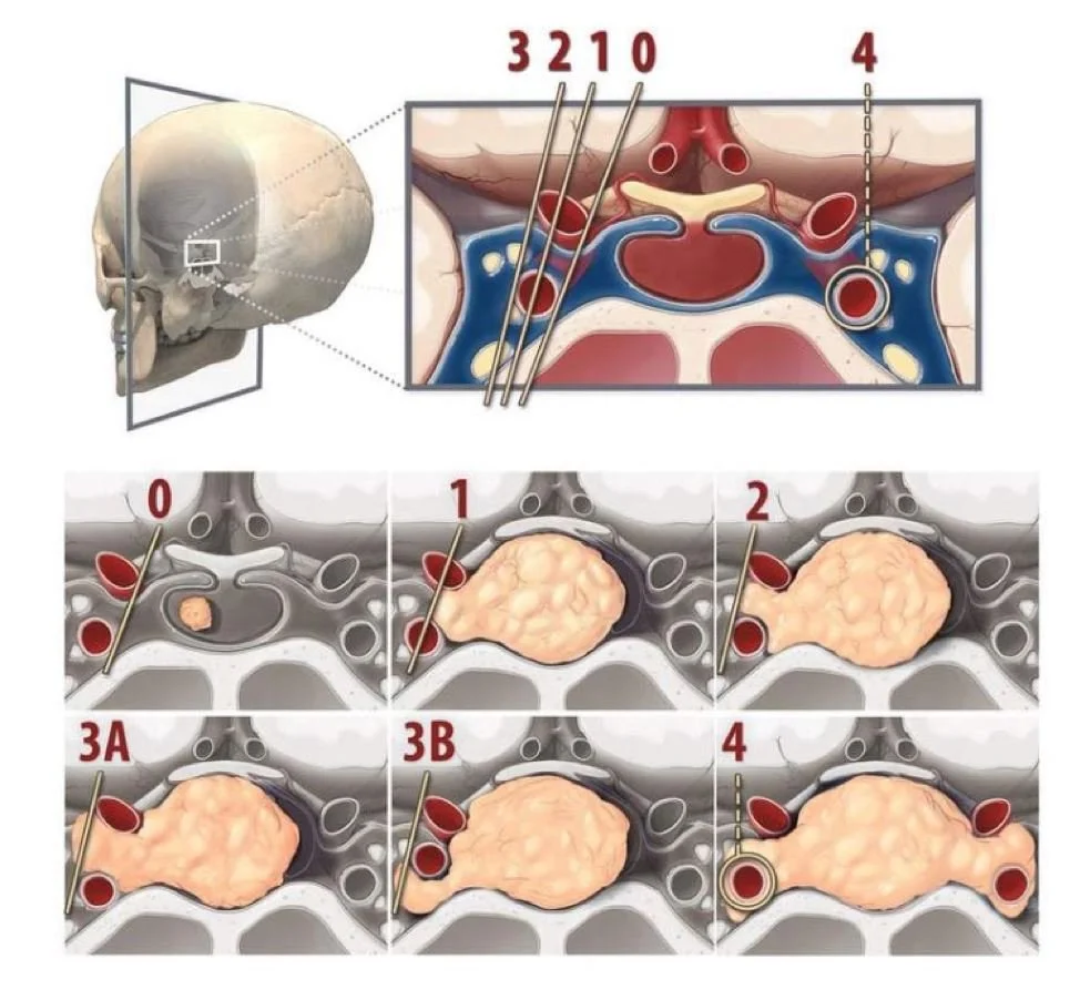 Classificação de KNOSP