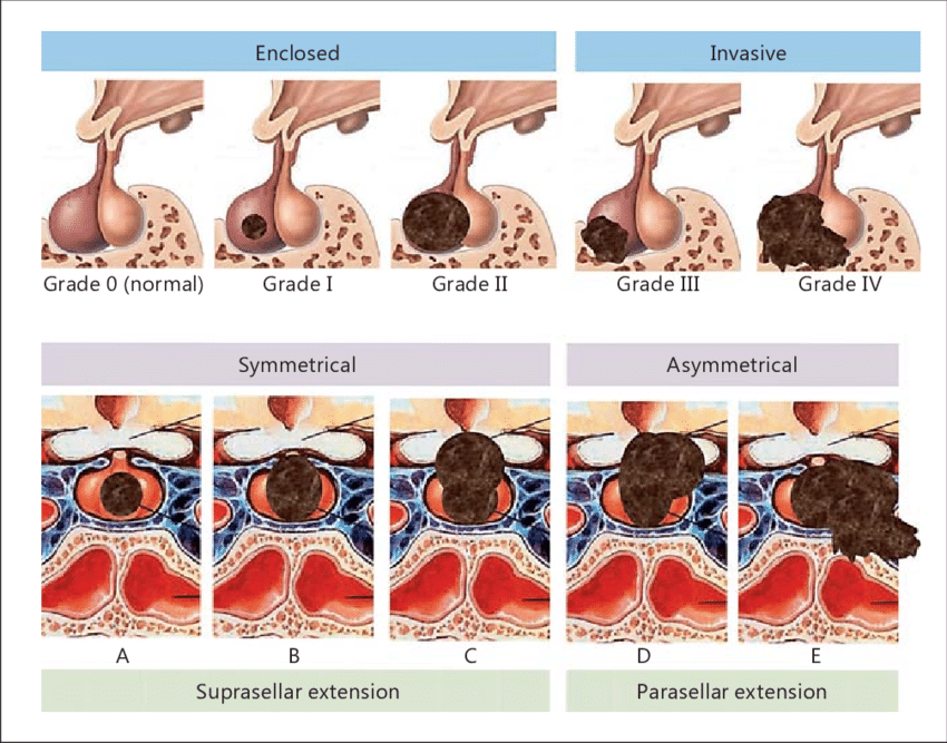 Classificação de WILSON-HARDY