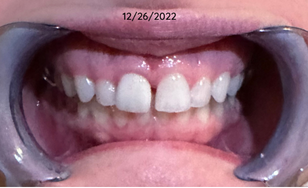 BLOG photos (4).png
