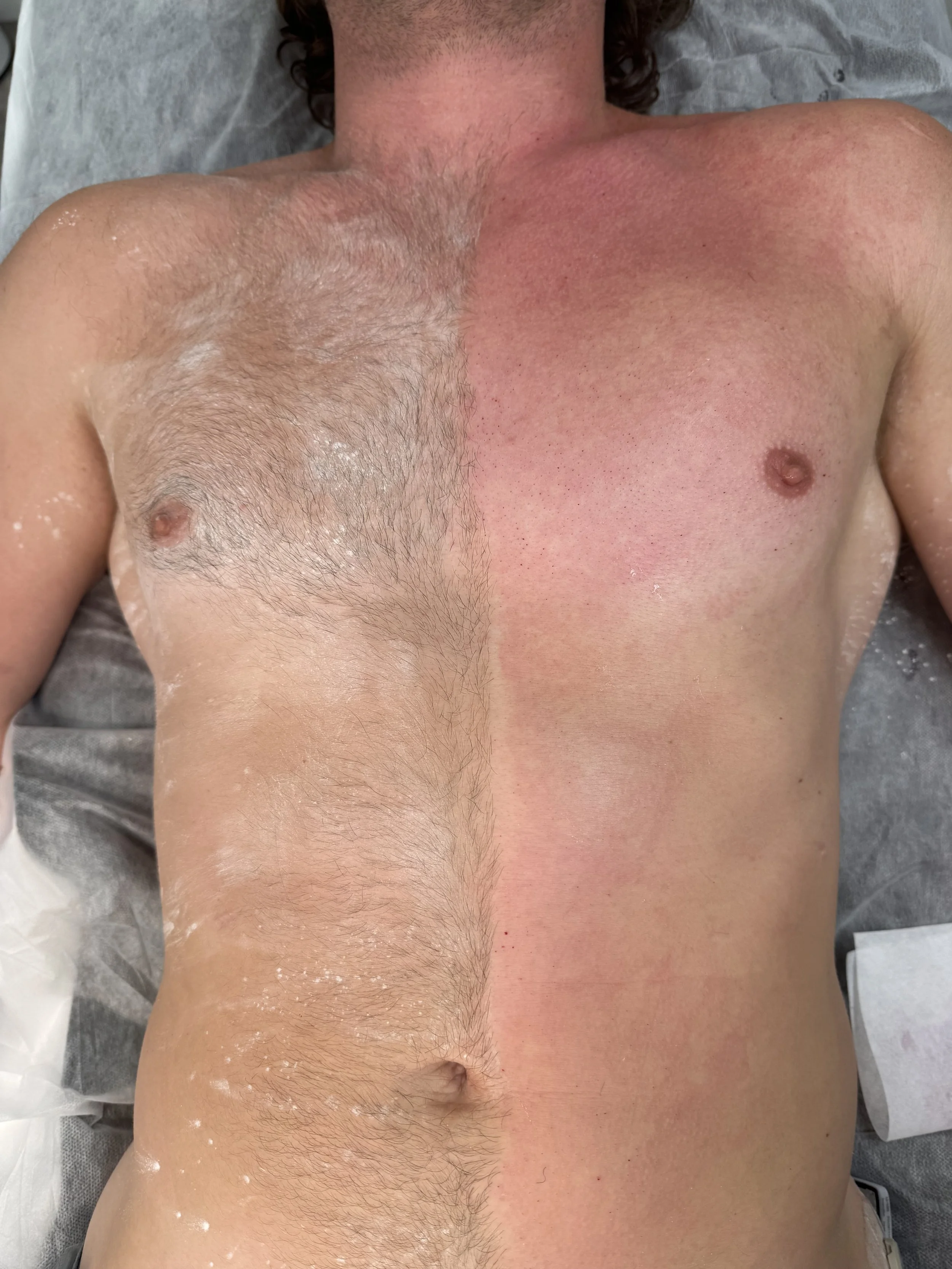 Chest Wax
