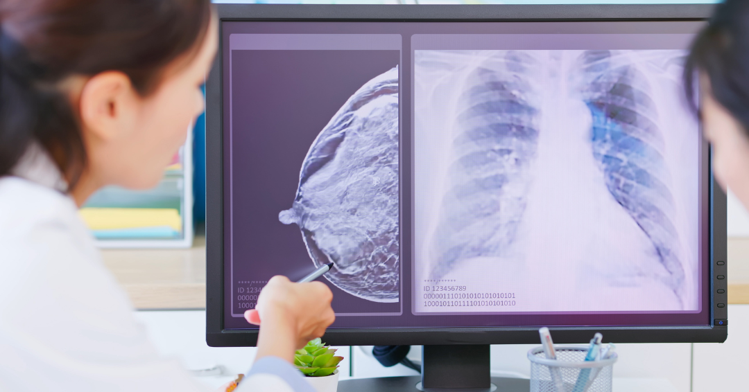 Breast Cancer Monitoring: Why We Track More Than “How You Feel”