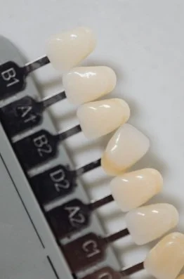 Dental shade guide with teeth samples labeled B1, A1, B2, D2, G1, and G2.