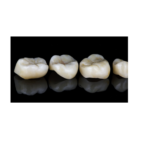Four dental crowns aligned from largest to smallest against a black background.