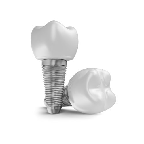 Two dental implants with tooth-shaped crowns, one standing and one lying on its side