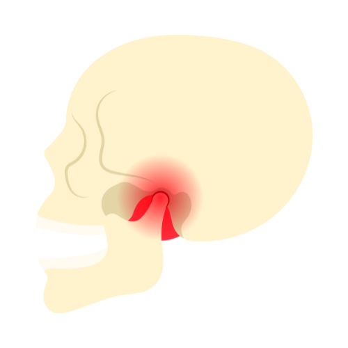 Diagram of a human skull showing pain in the throat area.