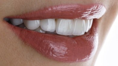 Close-up of a person's smiling mouth showing white teeth and lips with shiny lipstick.