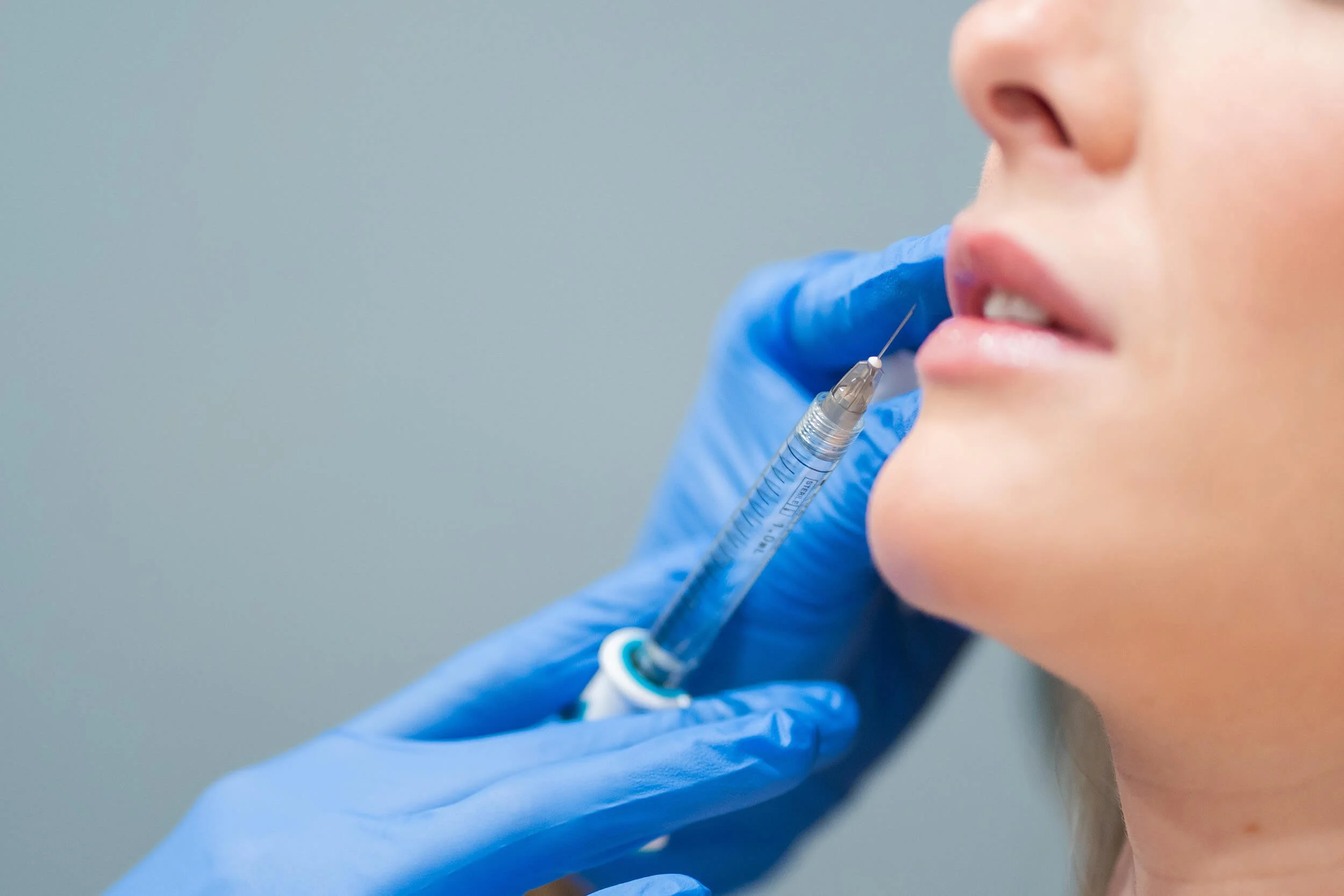 Person wearing blue gloves administering a vaccination or injection into a woman's lips.