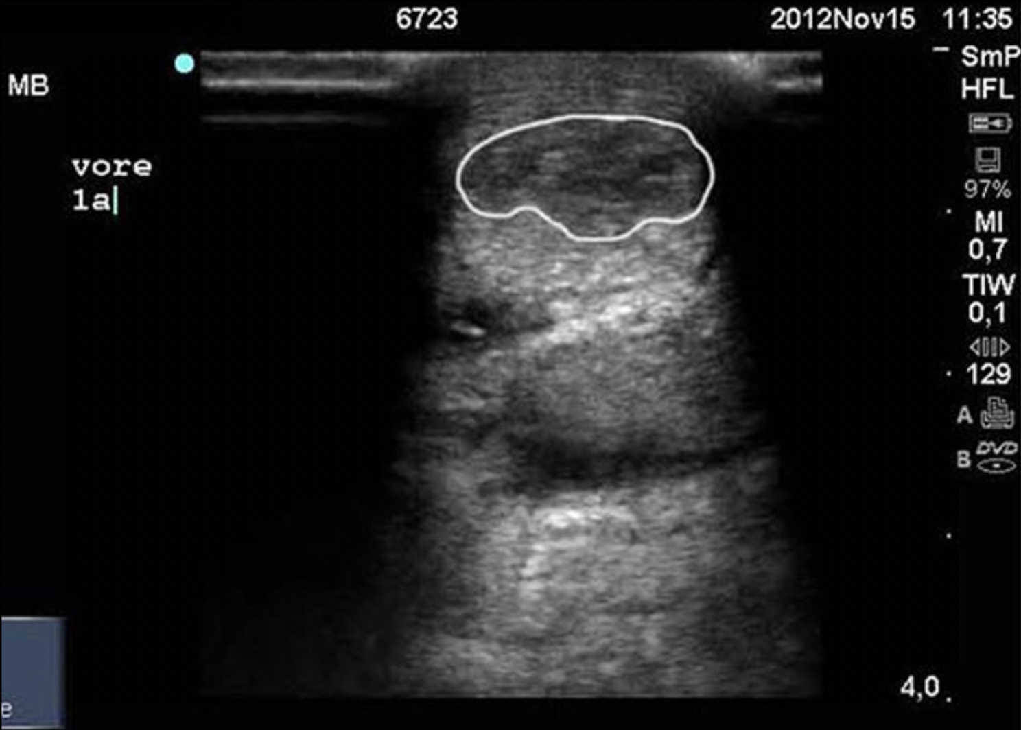 Whole body vibration revalidatie Vitafloor VM1 VM2 VM3 stalmodel vrijstaand trillingstherapie onderzoek Horse Control
