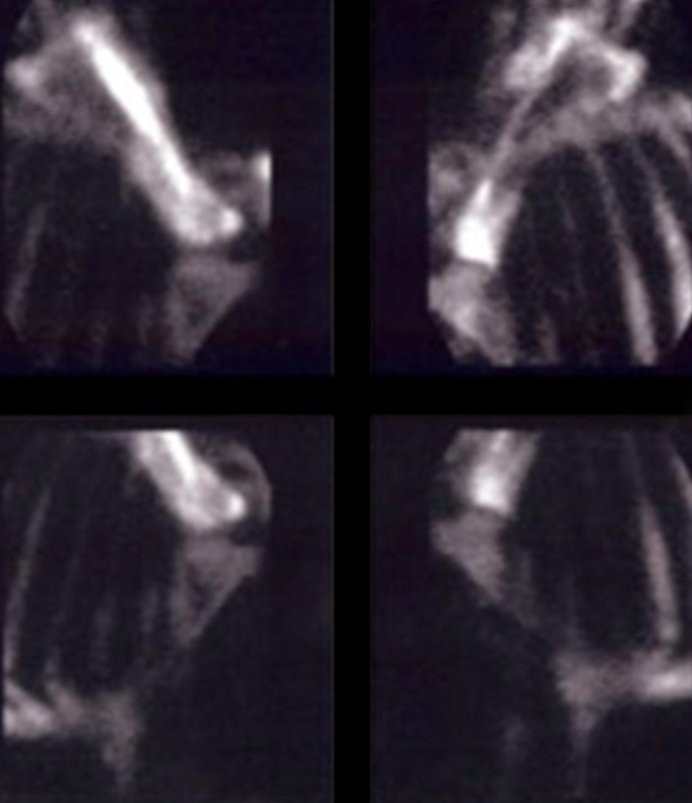 Whole body vibration revalidatie Vitafloor VM1 VM2 VM3 stalmodel vrijstaand trillingstherapie onderzoek Horse Control