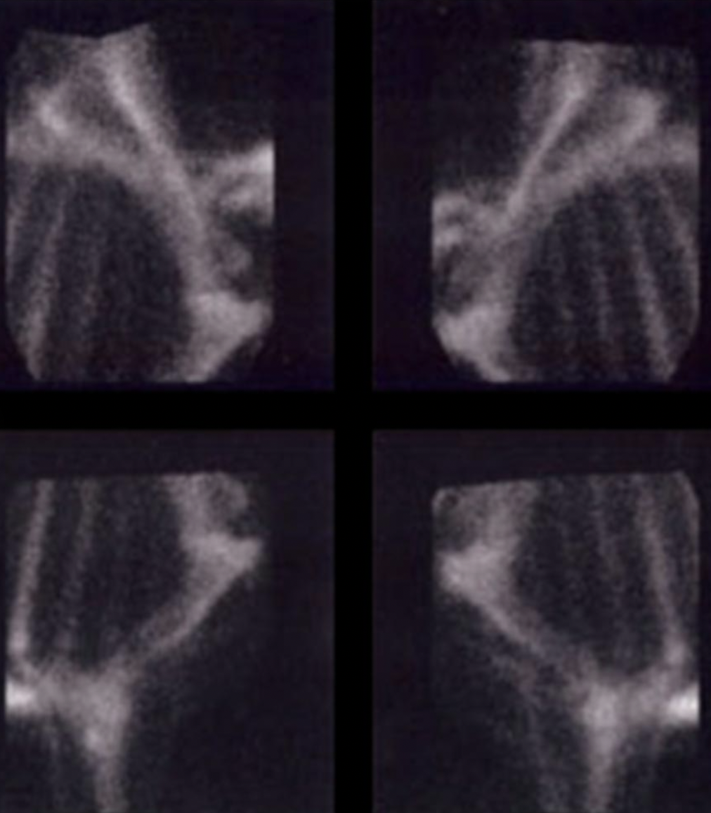 Whole body vibration revalidatie Vitafloor VM1 VM2 VM3 stalmodel vrijstaand trillingstherapie onderzoek Horse Control