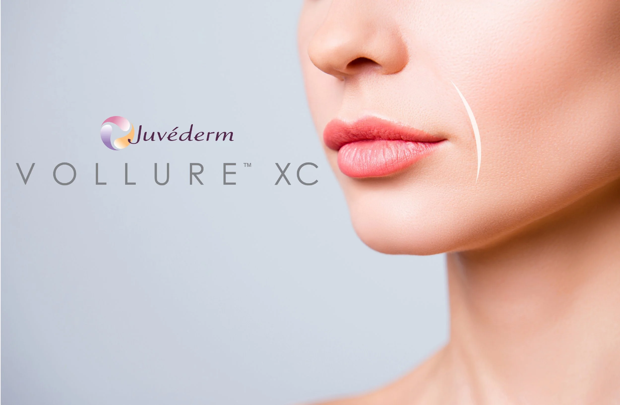 Close-up of a woman's lower face showing smooth skin and pink lips, with product branding for Juvéderm Vollure XC on the left side.