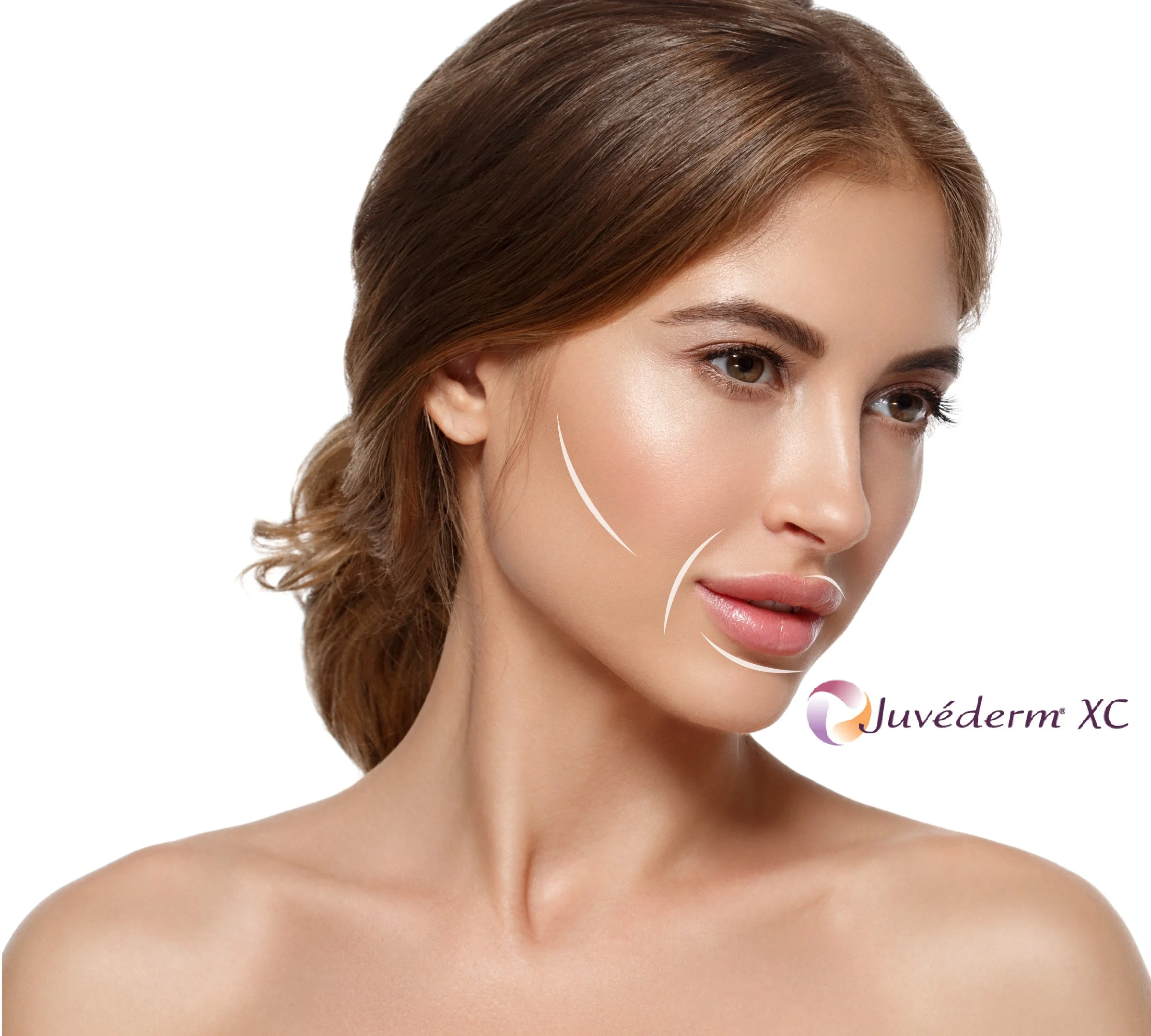 A woman with clear skin and brown hair, highlights of facial treatment or skin care, Juvederm XC logo at the bottom right corner.